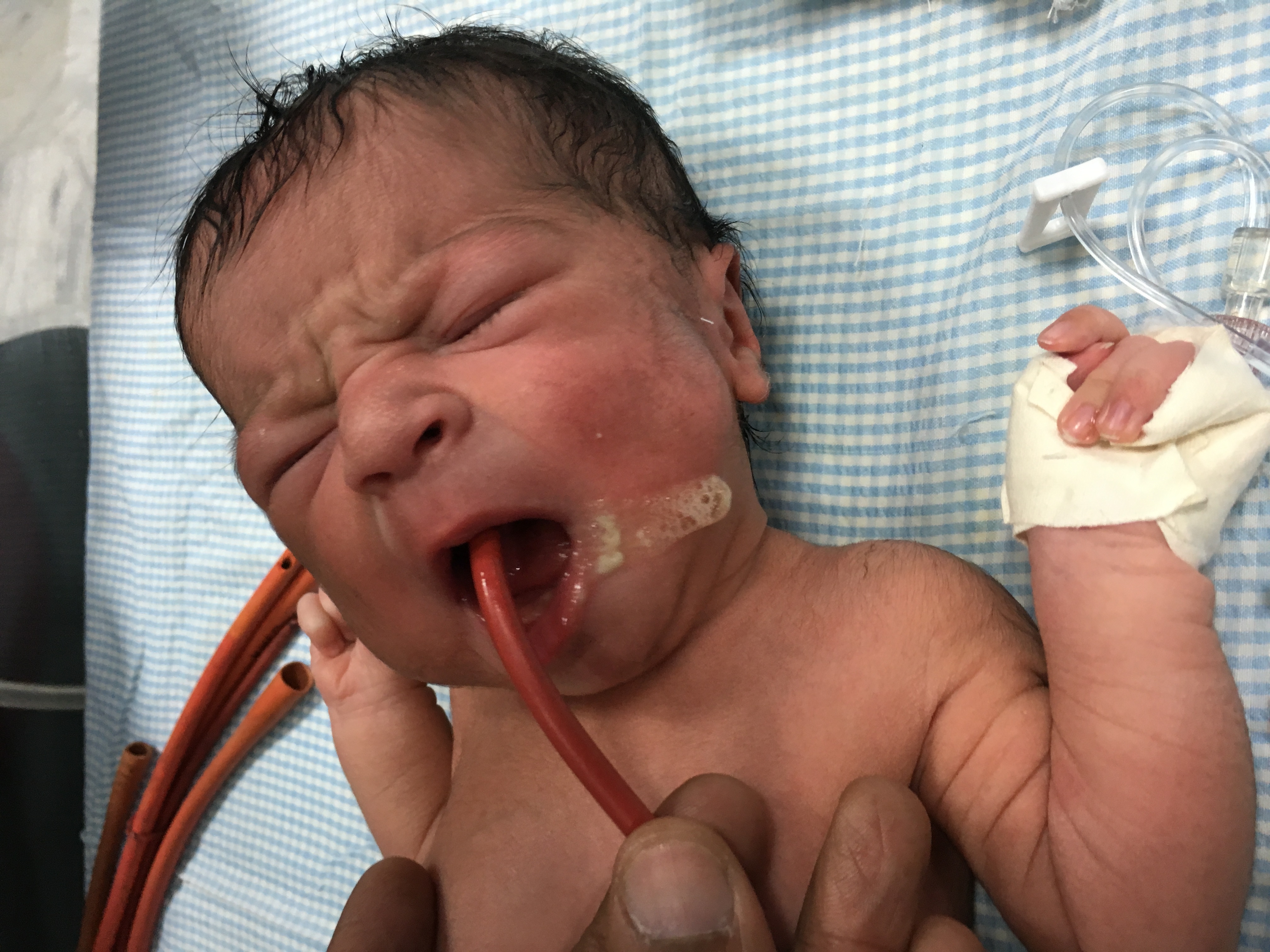 Pediatric G.I. Surgery Image 5